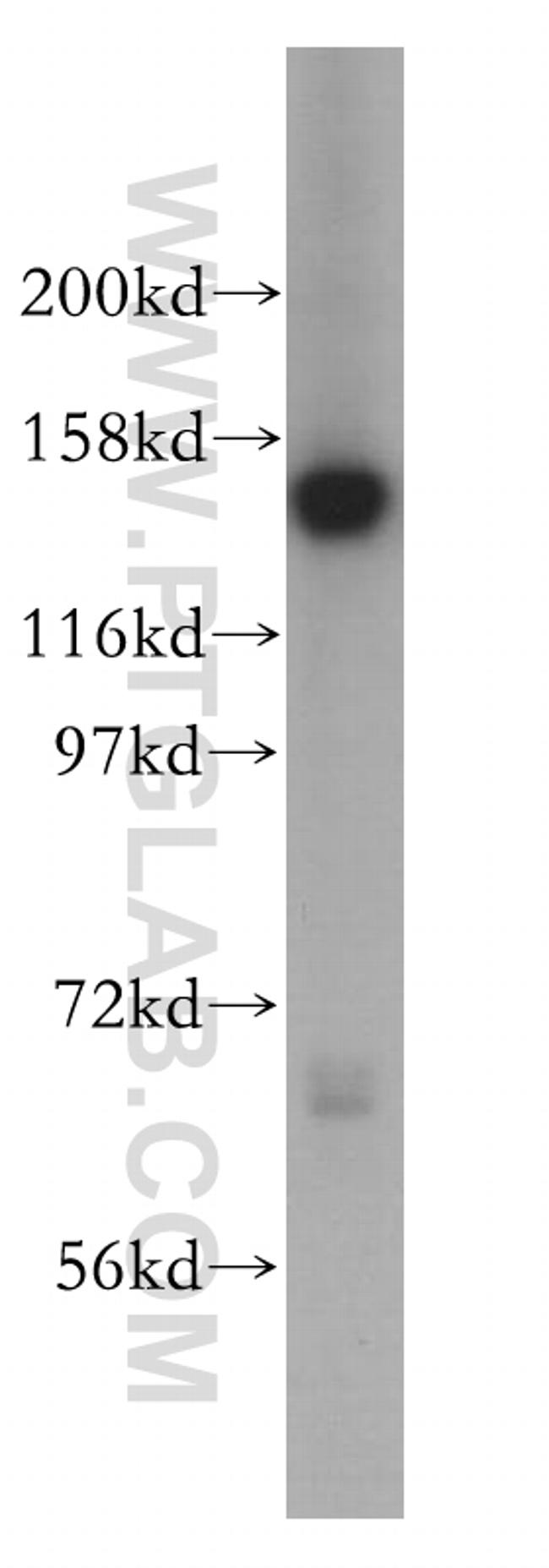 SIN3A Antibody in Western Blot (WB)