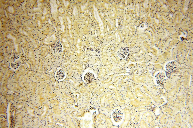 CHMP1B Antibody in Immunohistochemistry (Paraffin) (IHC (P))