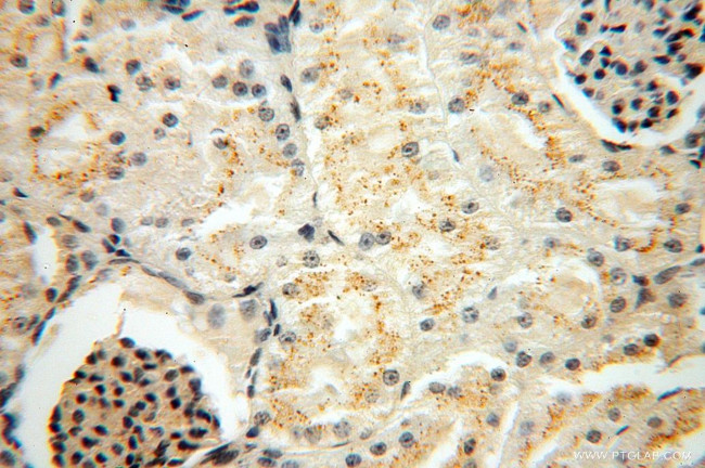 CHMP1B Antibody in Immunohistochemistry (Paraffin) (IHC (P))