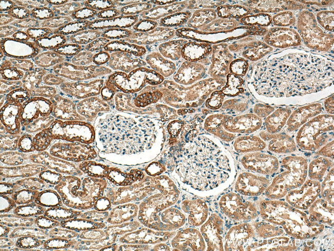 CHMP1B Antibody in Immunohistochemistry (Paraffin) (IHC (P))