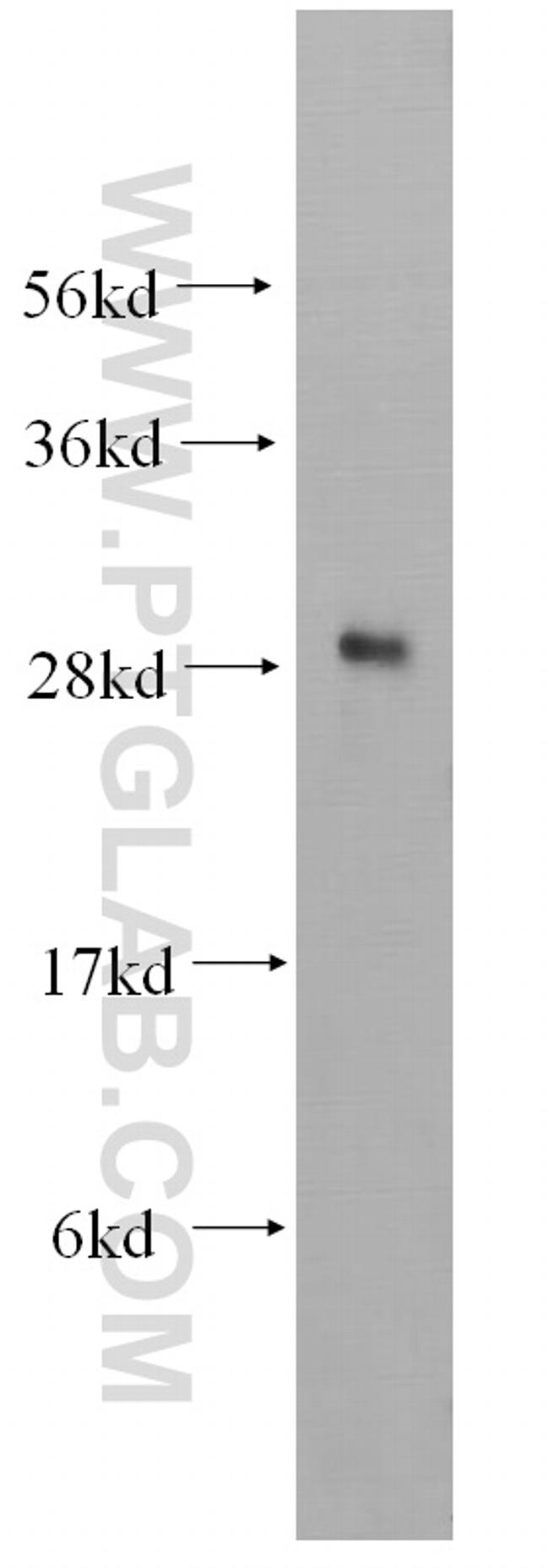 CHMP1B Antibody in Western Blot (WB)