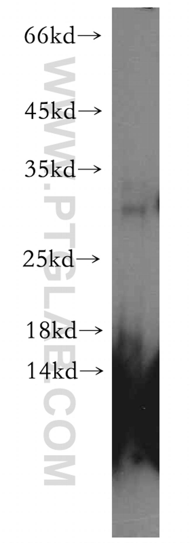 CHMP1B Antibody in Western Blot (WB)