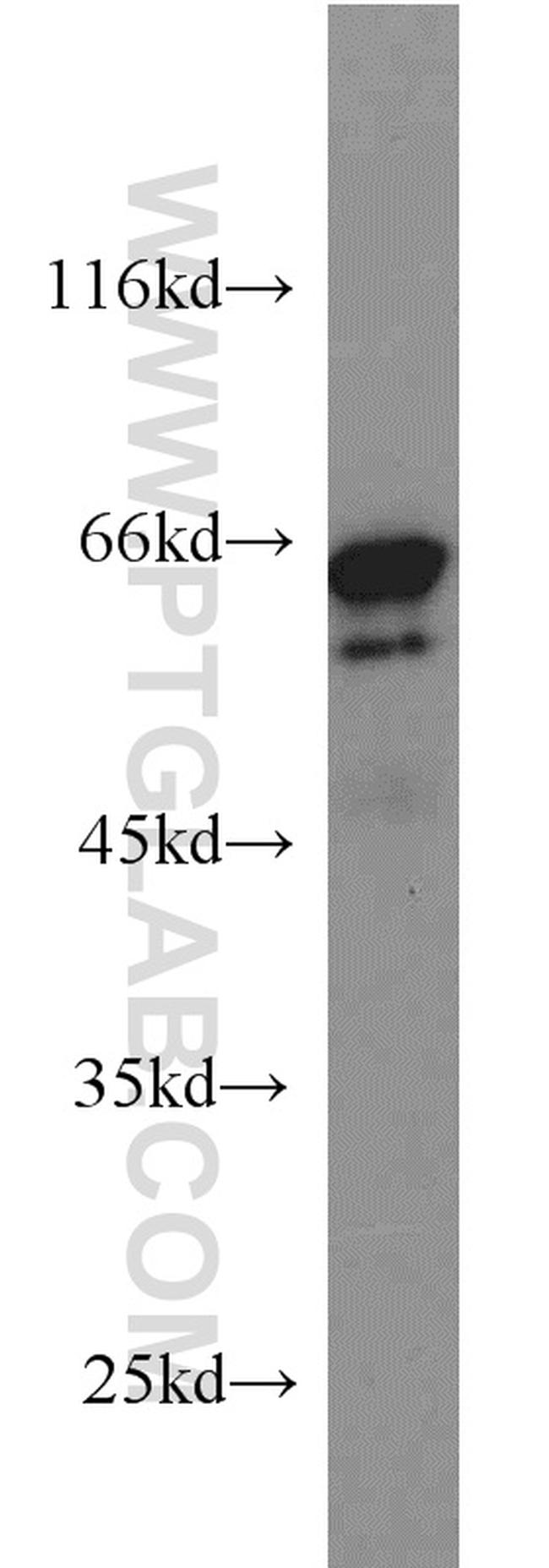 IGF2BP3 Antibody in Western Blot (WB)