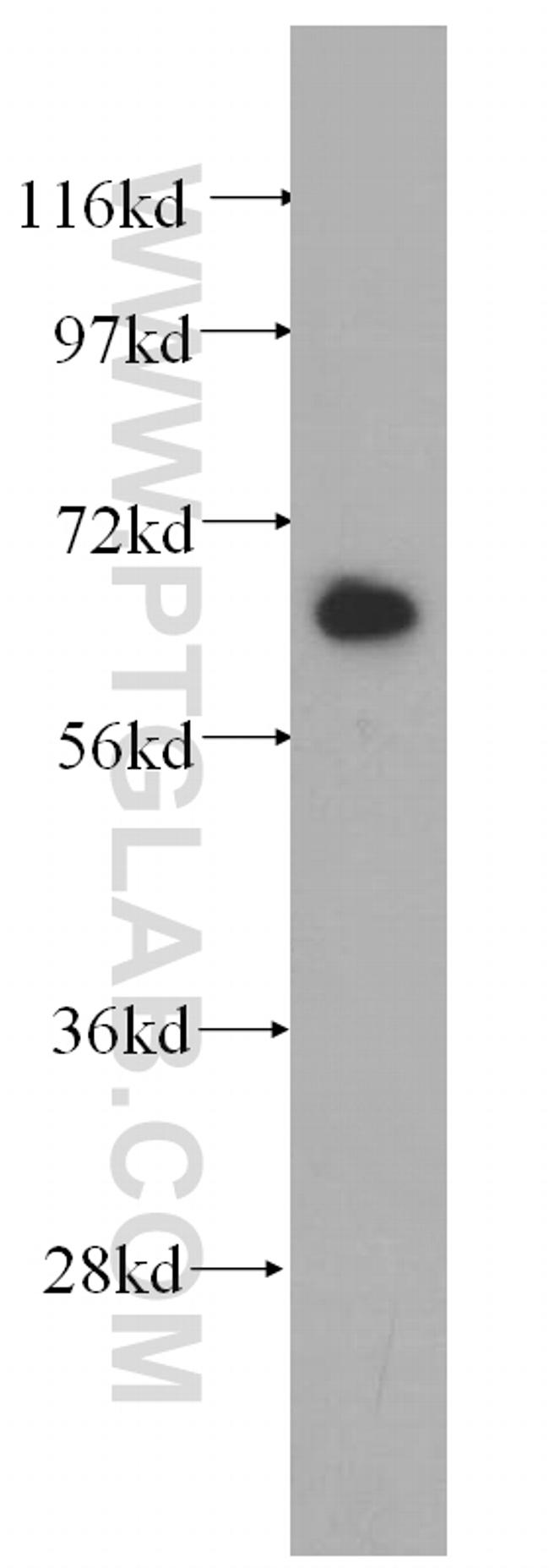 IGF2BP3 Antibody in Western Blot (WB)