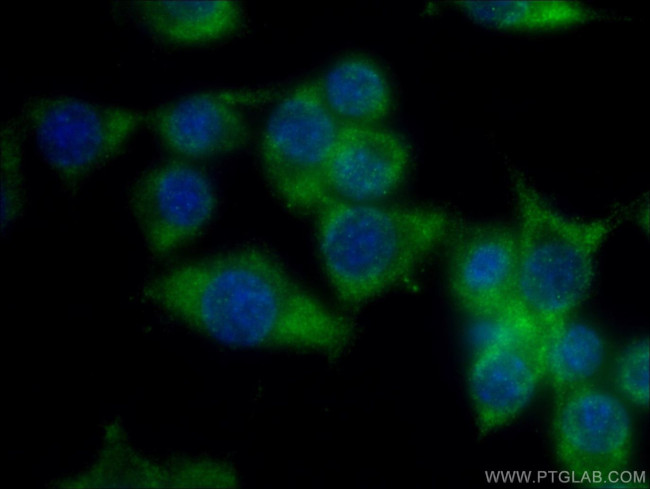RDH10 Antibody in Immunocytochemistry (ICC/IF)