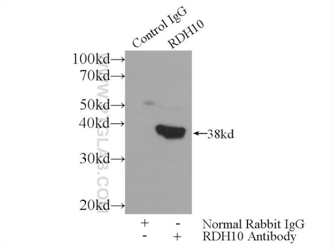 RDH10 Antibody in Immunoprecipitation (IP)