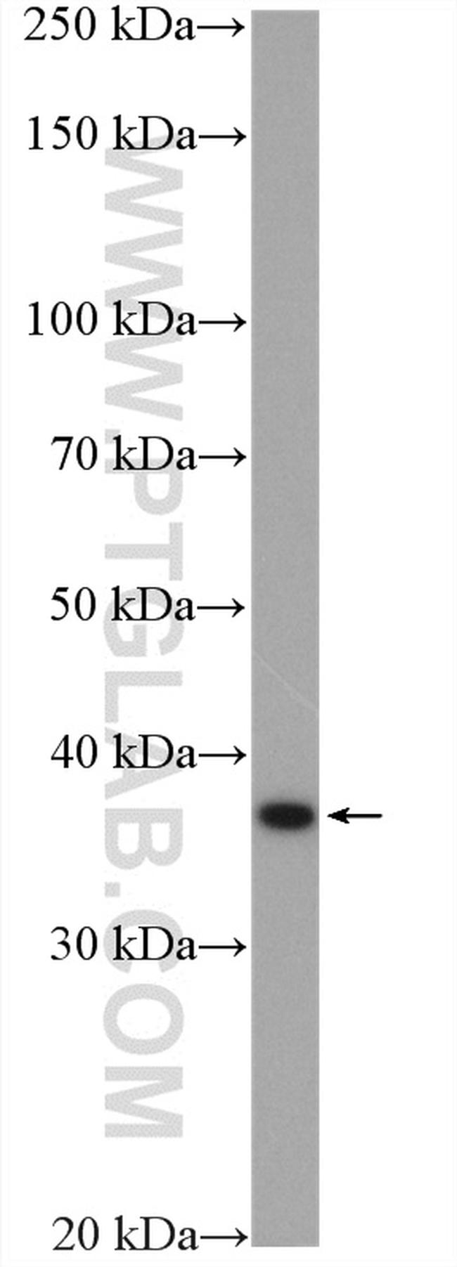 RDH10 Antibody in Western Blot (WB)