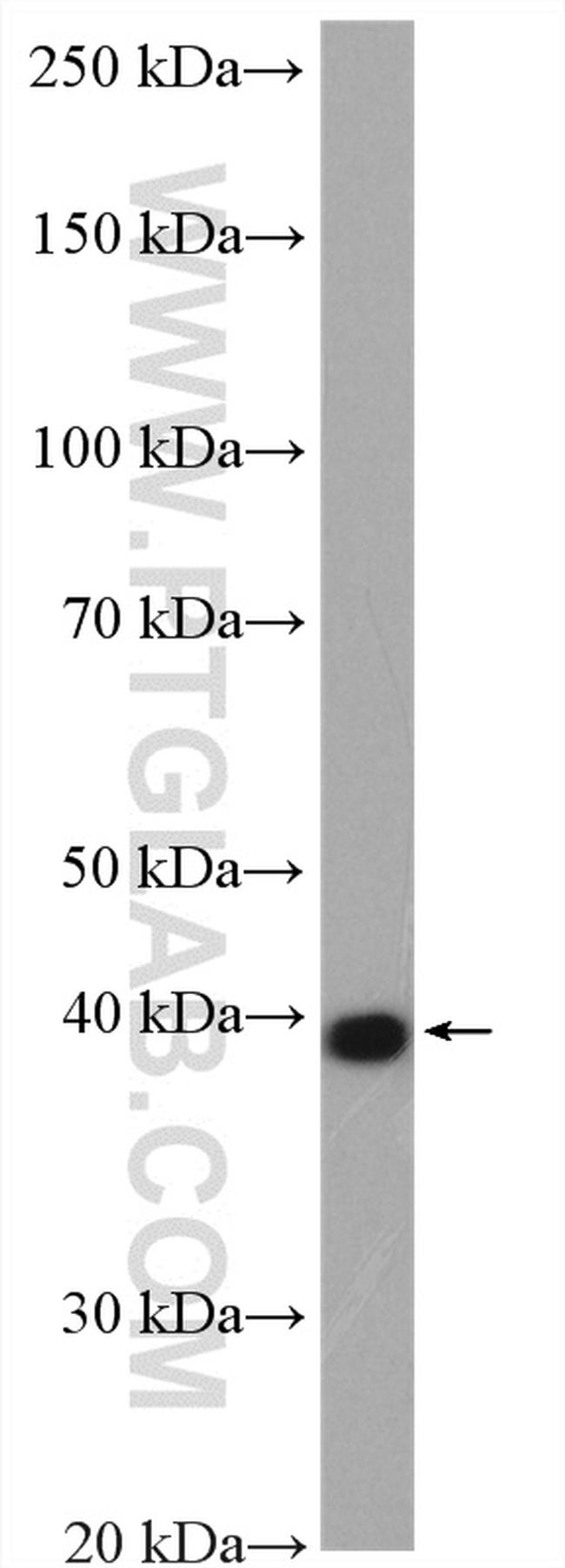 RDH10 Antibody in Western Blot (WB)