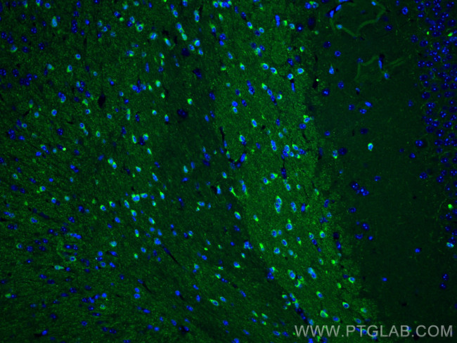 BIN1 Antibody in Immunohistochemistry (PFA fixed) (IHC (PFA))