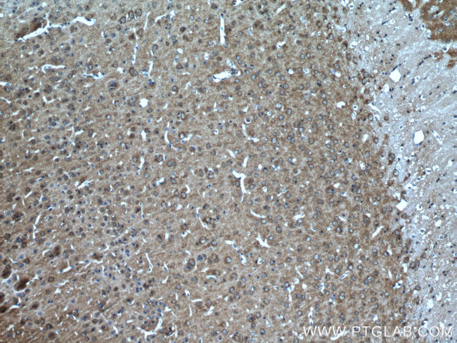 POSH Antibody in Immunohistochemistry (Paraffin) (IHC (P))