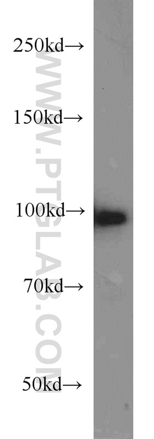 POSH Antibody in Western Blot (WB)