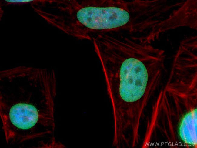 LAP2 Antibody in Immunocytochemistry (ICC/IF)