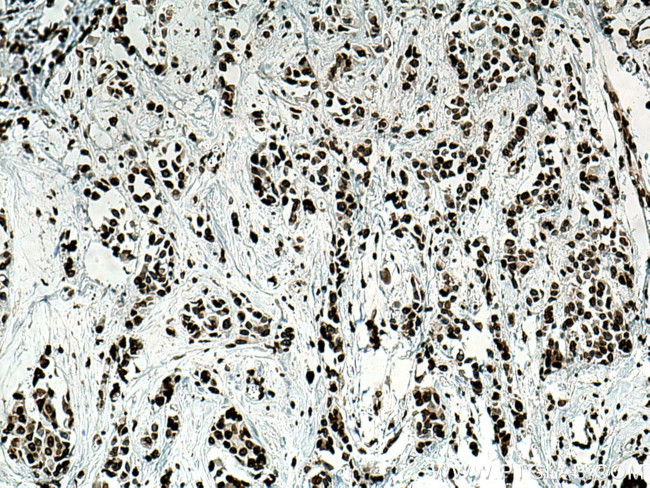 LAP2 Antibody in Immunohistochemistry (Paraffin) (IHC (P))