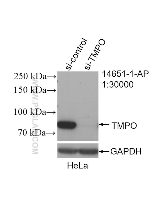 LAP2 Antibody in Western Blot (WB)