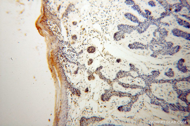 LAP2 Antibody in Immunohistochemistry (Paraffin) (IHC (P))