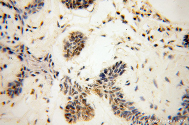 LAP2 Antibody in Immunohistochemistry (Paraffin) (IHC (P))