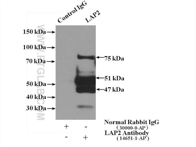 LAP2 Antibody in Immunoprecipitation (IP)