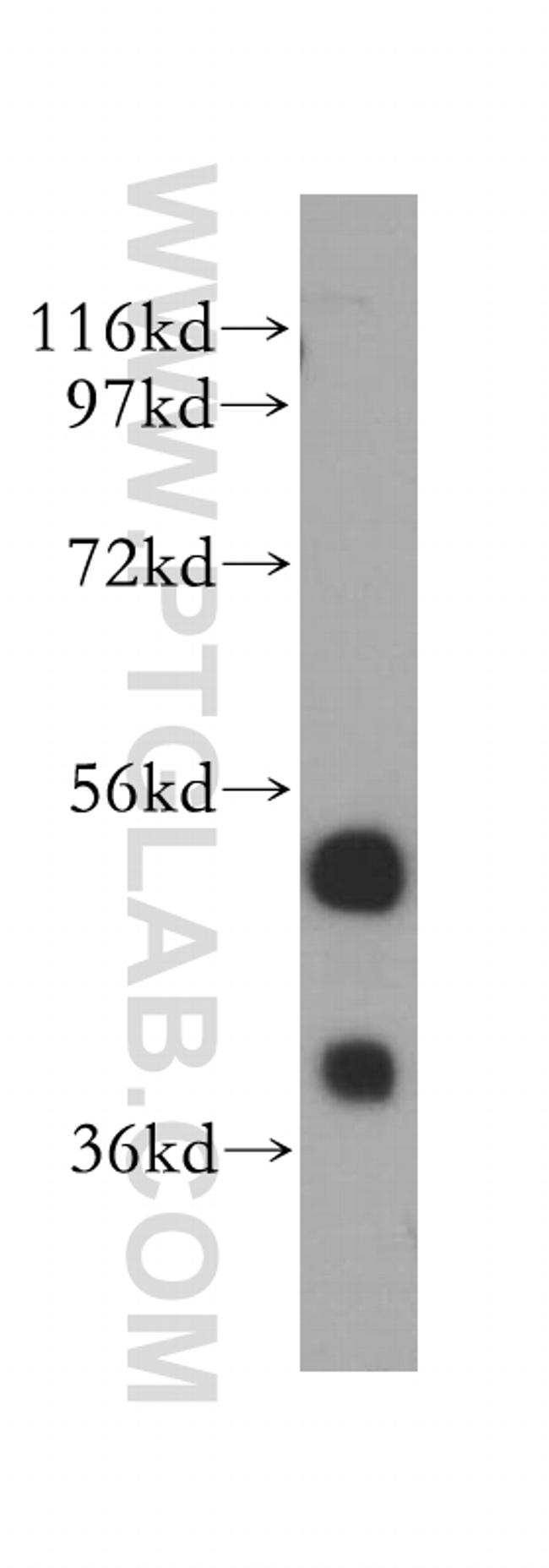 LAP2 Antibody in Western Blot (WB)