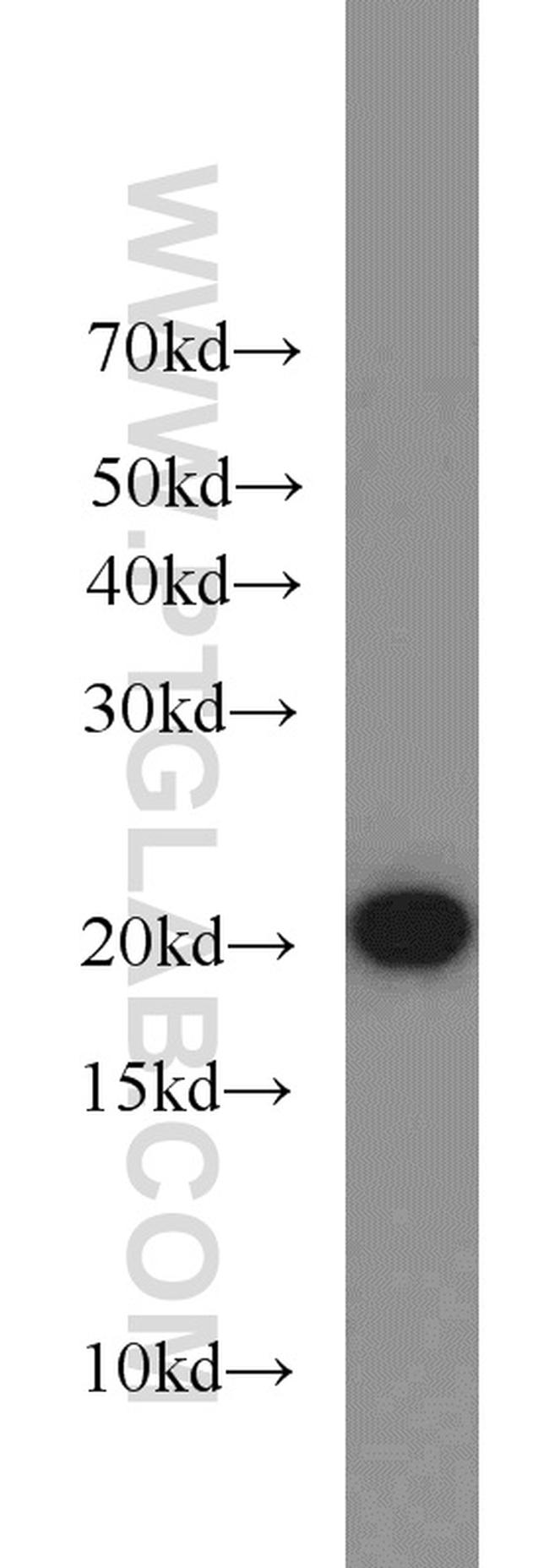 ARPC3 Antibody in Western Blot (WB)