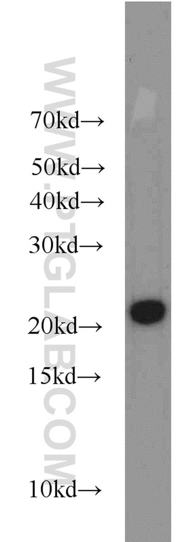 ARPC3 Antibody in Western Blot (WB)