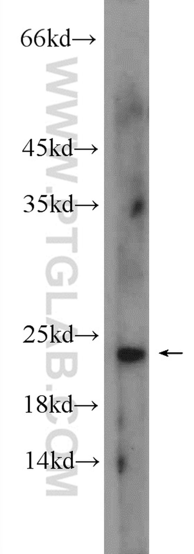 EIF1AX Antibody in Western Blot (WB)