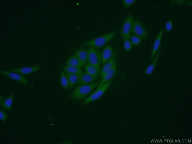 EIF1AX Antibody in Immunocytochemistry (ICC/IF)