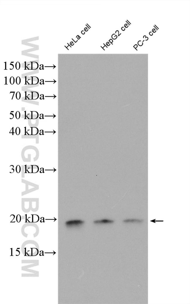 EIF1AX Antibody in Western Blot (WB)