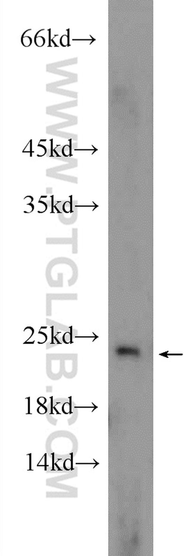 EIF1AX Antibody in Western Blot (WB)