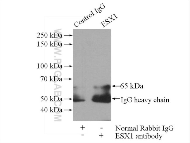 ESX1 Antibody in Immunoprecipitation (IP)