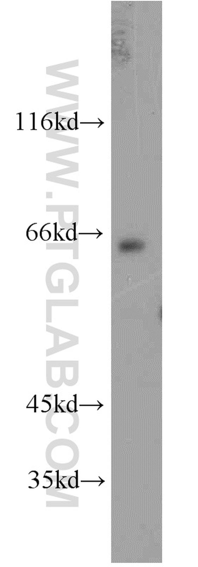 ESX1 Antibody in Western Blot (WB)