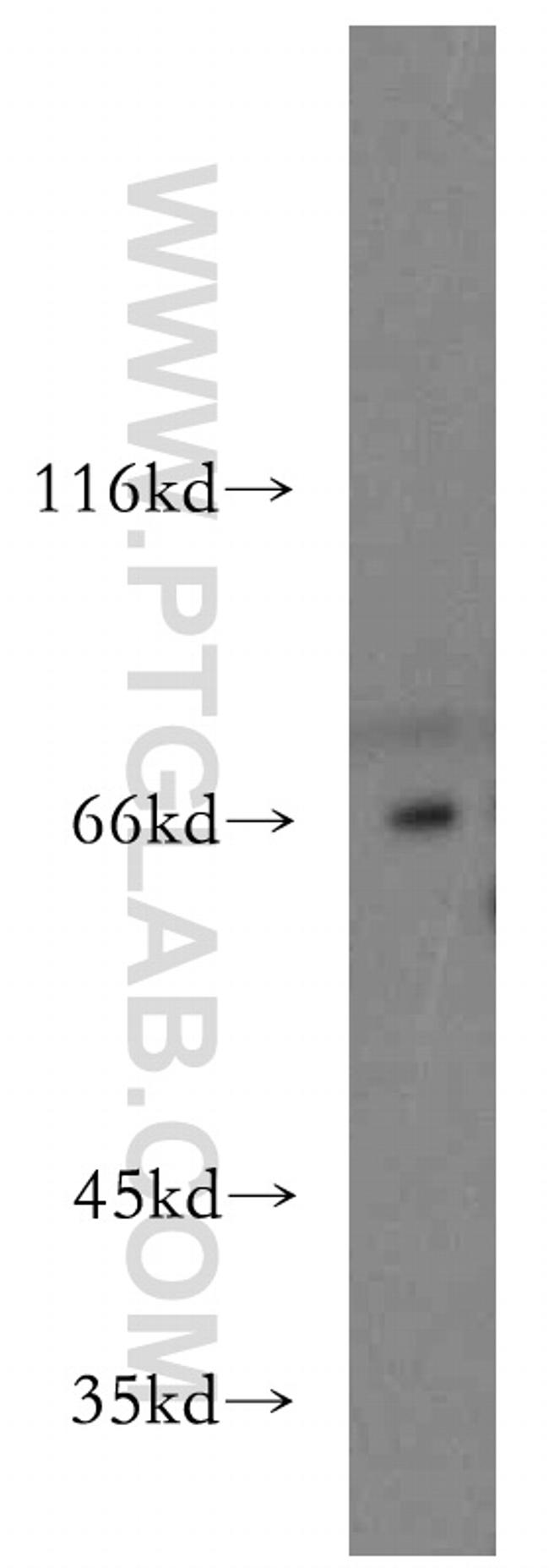 ESX1 Antibody in Western Blot (WB)