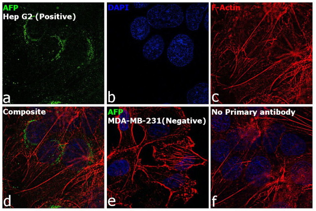 alpha-Fetoprotein Antibody in Immunocytochemistry (ICC/IF)