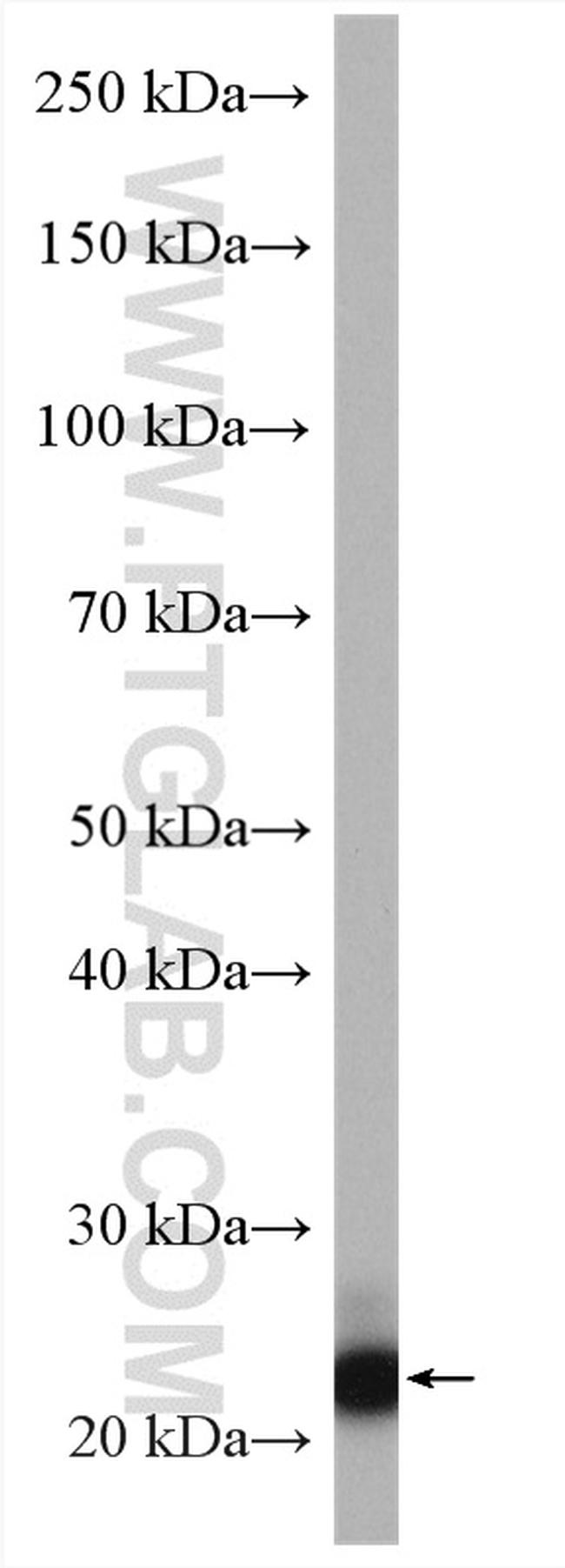 PHLDA2 Antibody in Western Blot (WB)