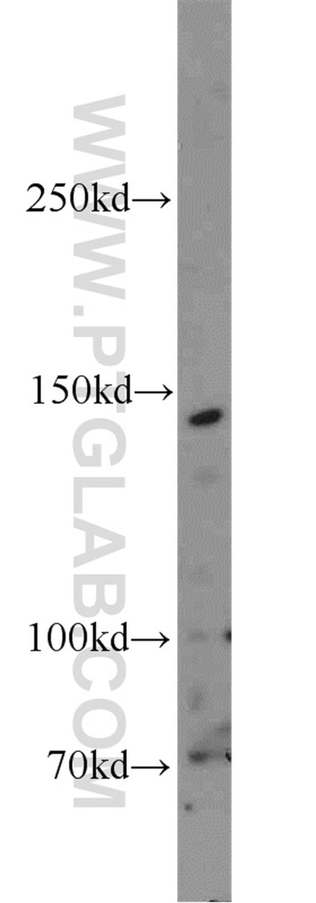 AFF4 Antibody in Western Blot (WB)