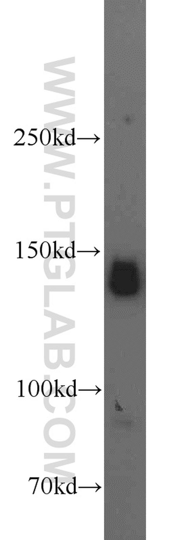 AFF4 Antibody in Western Blot (WB)