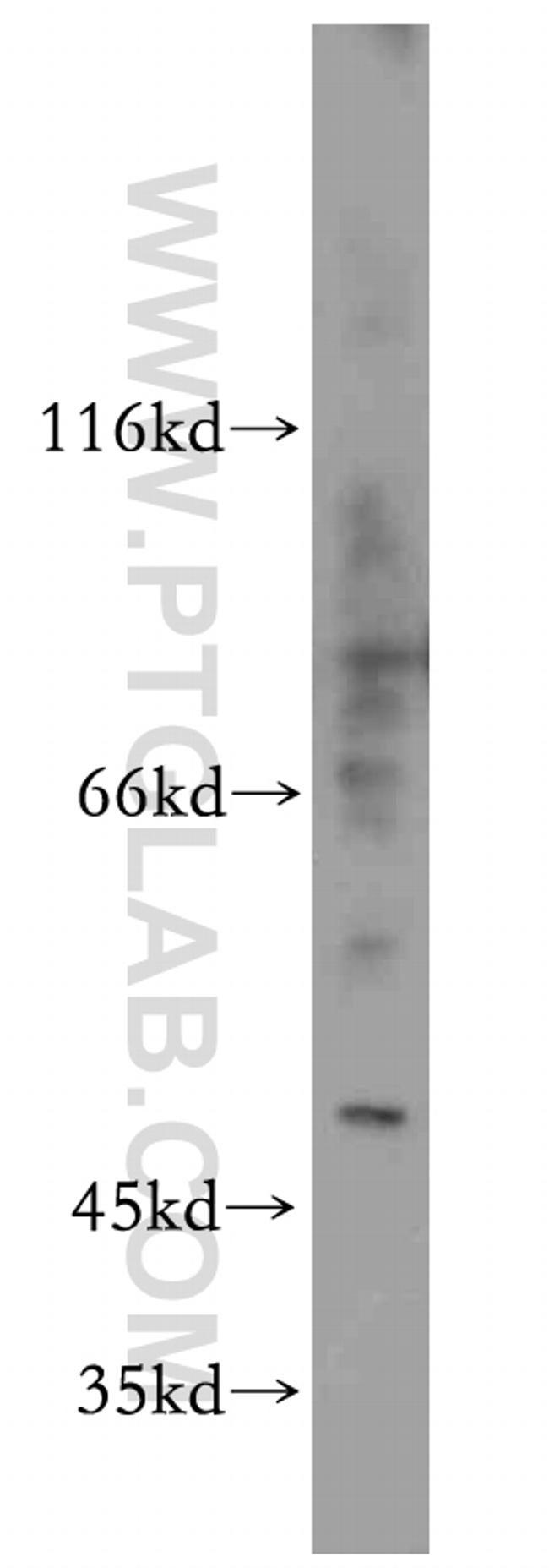 ELK4 Antibody in Western Blot (WB)