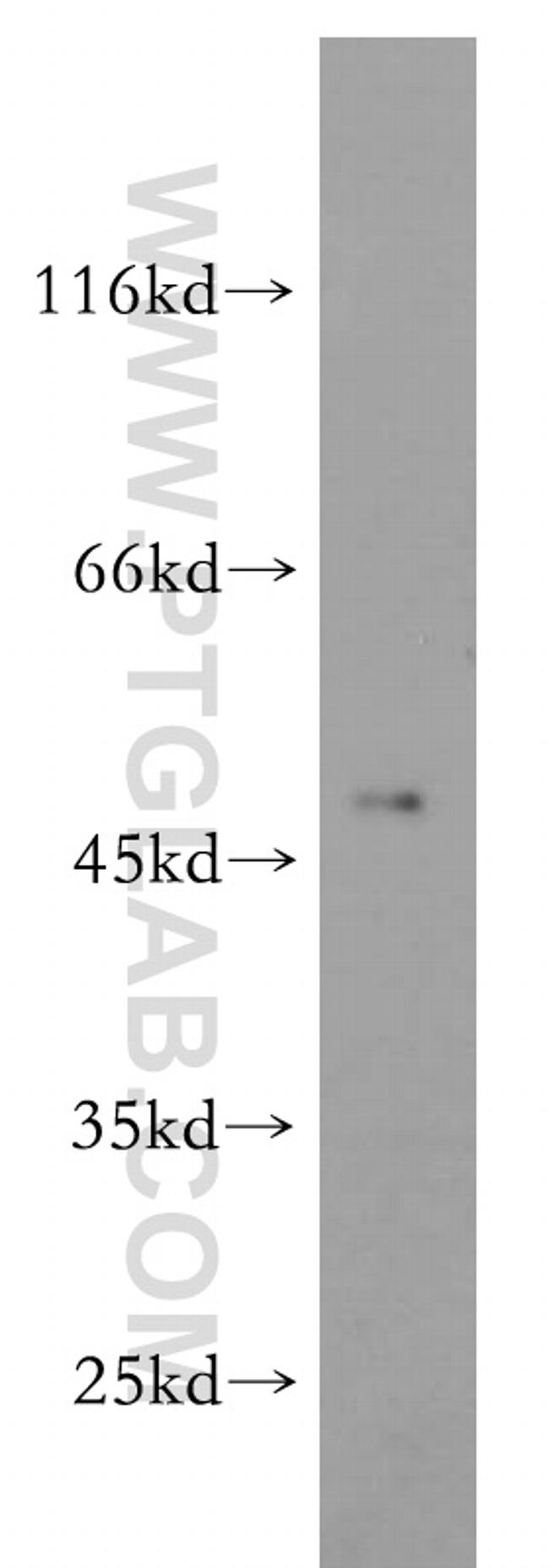 ELK4 Antibody in Western Blot (WB)