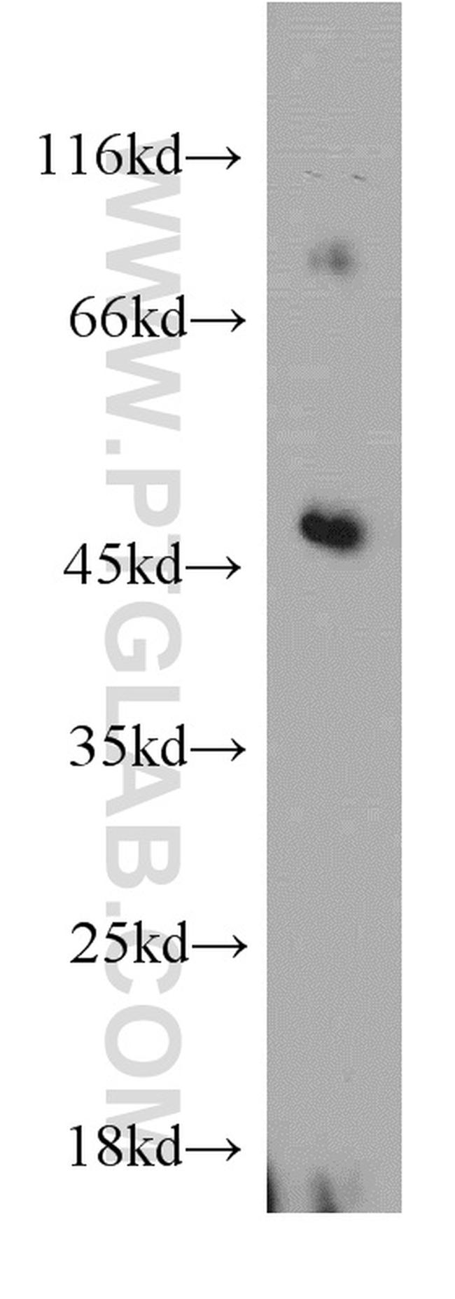 ELK4 Antibody in Western Blot (WB)