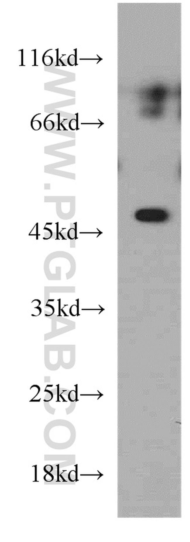 ELK4 Antibody in Western Blot (WB)