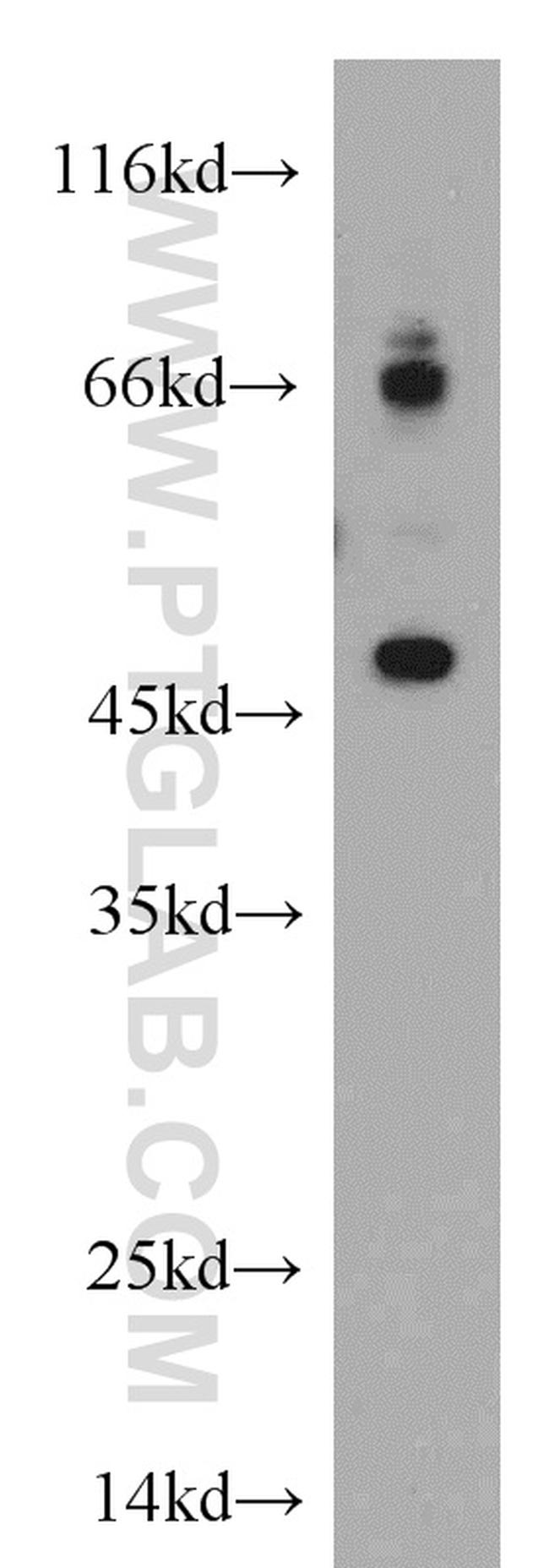 ELK4 Antibody in Western Blot (WB)