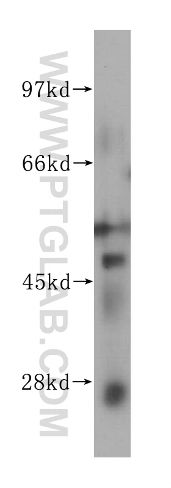 ELK4 Antibody in Western Blot (WB)