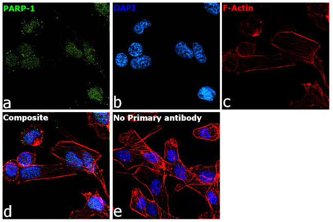 PARP1 Antibody in Immunocytochemistry (ICC/IF)