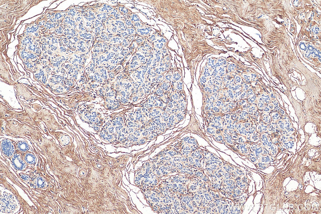 Decorin Antibody in Immunohistochemistry (Paraffin) (IHC (P))