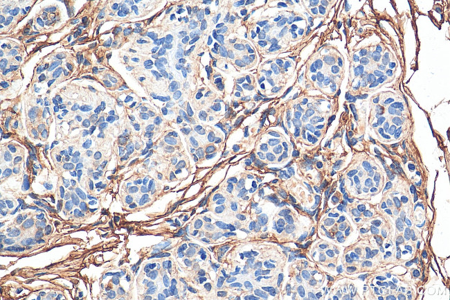 Decorin Antibody in Immunohistochemistry (Paraffin) (IHC (P))