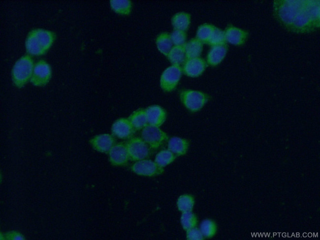 Decorin Antibody in Immunocytochemistry (ICC/IF)