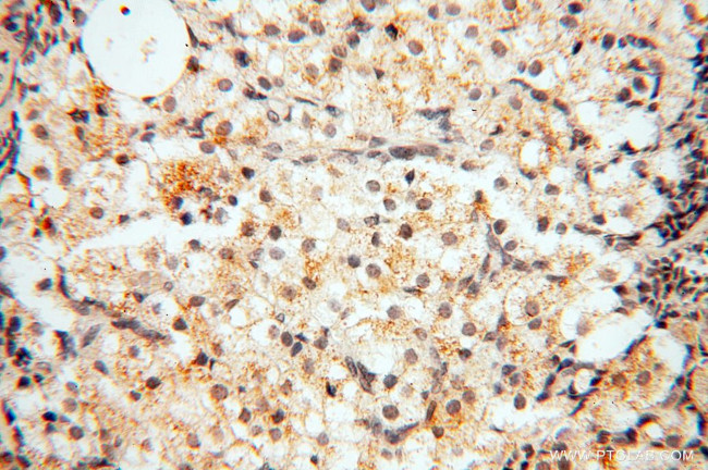 Decorin Antibody in Immunohistochemistry (Paraffin) (IHC (P))