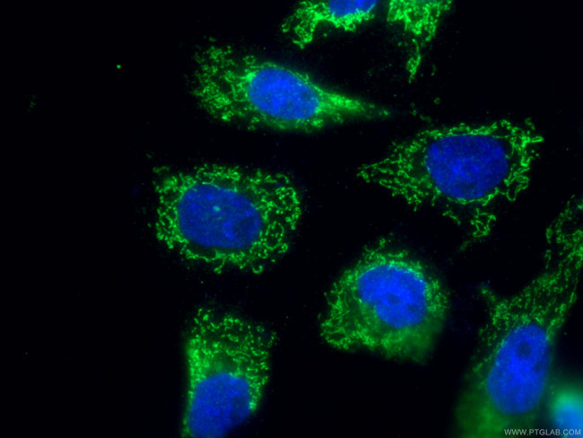 SLC25A24 Antibody in Immunocytochemistry (ICC/IF)