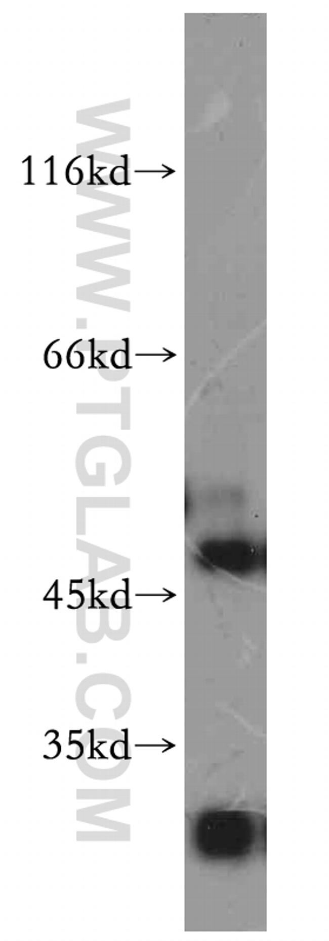 SLC25A24 Antibody in Western Blot (WB)