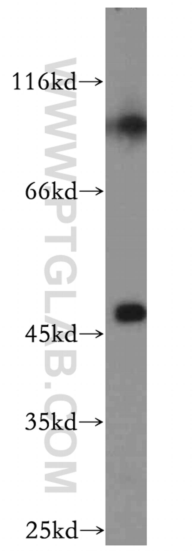 SLC25A24 Antibody in Western Blot (WB)