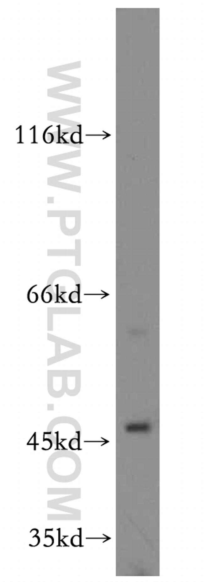 SLC25A24 Antibody in Western Blot (WB)